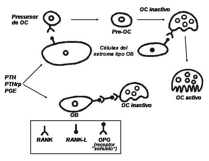 osteopo01