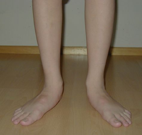 2-12