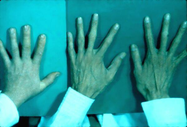 3-09