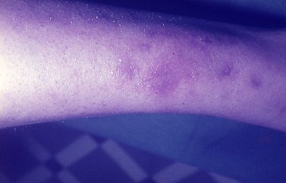9-33