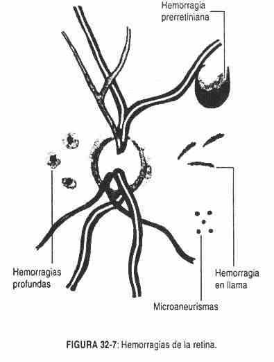 haneuro07