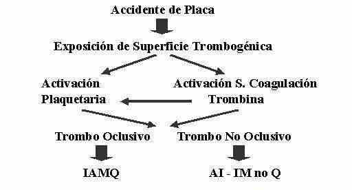 infarto3
